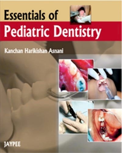 Essentials of Pediatric Dentistry 1st edition