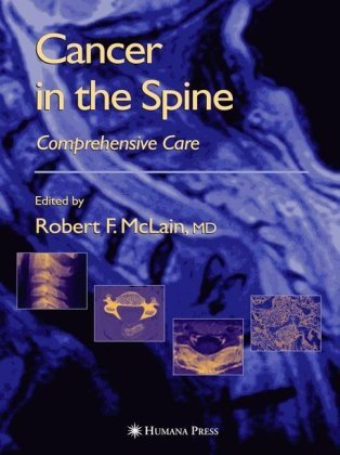 Cancer in the Spine Comprehensive Care