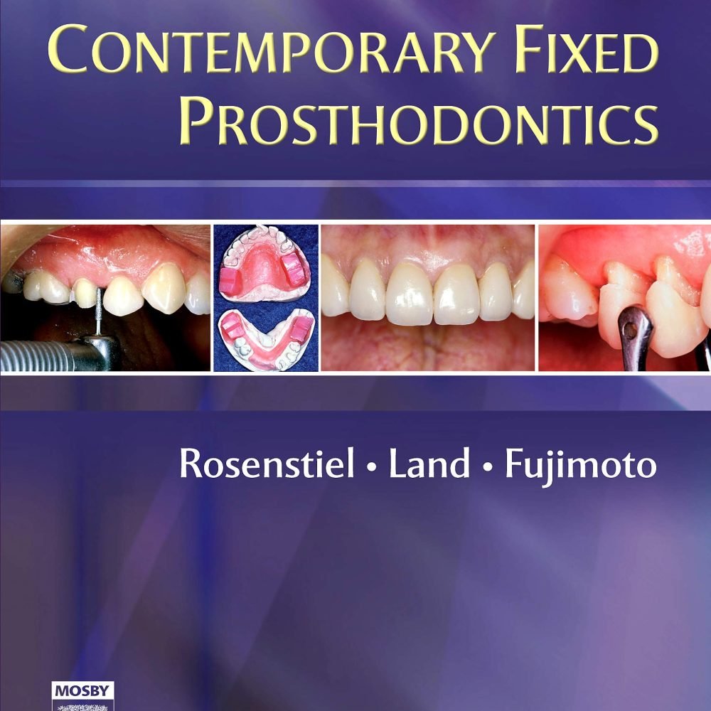 Contemporary Fixed Prosthodontics