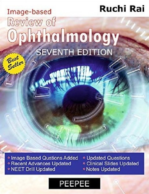 Review of Ophthalmology seventh edition