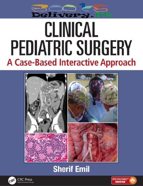 Clinical Pediatric Surgery A Case-Based Interactive Approach 1st Edition.