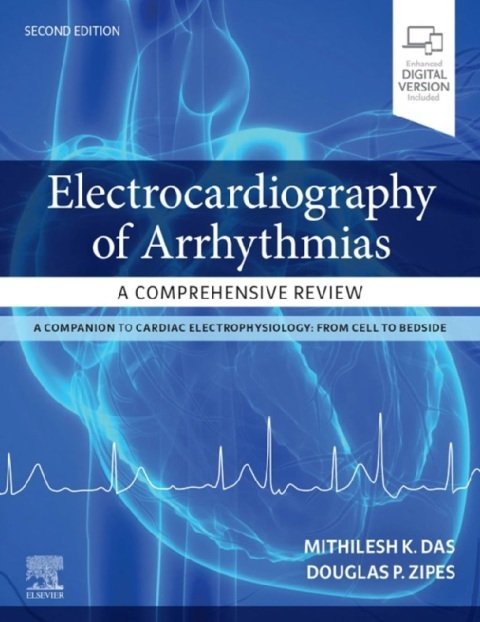 Electrocardiography of Arrhythmias A Comprehensive Review A Companion to Cardiac Electrophysiology 2nd Edition.
