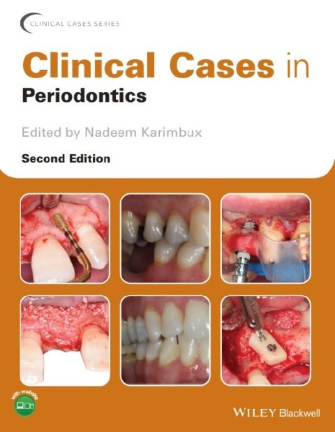Clinical Cases in Periodontics (Clinical Cases (Dentistry)) 2nd Edition.