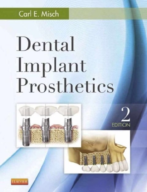 Dental Implant Prosthetics 2nd Edition.