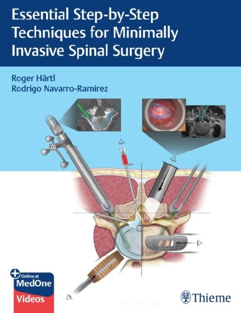 Essential Step-by-Step Techniques for Minimally Invasive Spinal Surgery 1st Edition.