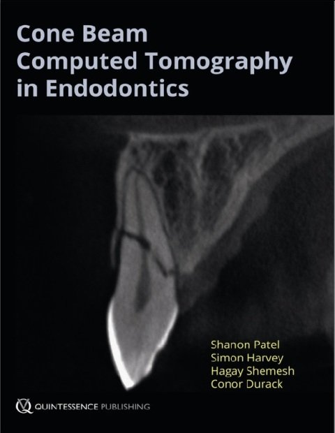 Cone Beam Computed Tomography in Endodontics 1st Edition.