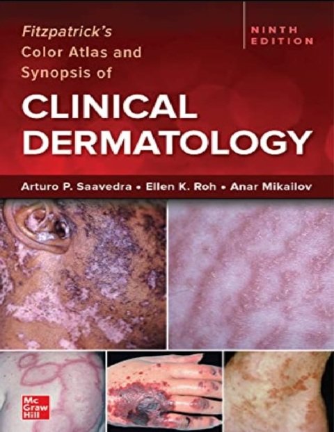 Fitzpatrick's Color Atlas and Synopsis of Clinical Dermatology, Ninth Edition 9th Edition.