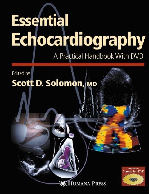 Essential Echocardiography A Practical Handbook with DVD (Contemporary Cardiology) 2007th Edition.