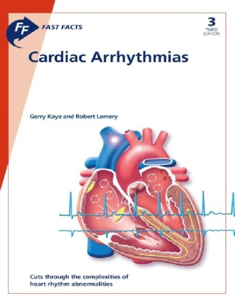 Fast Facts Cardiac Arrhythmias 3rd edition.