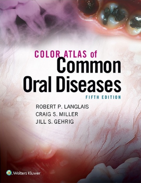 Color Atlas of Common Oral Diseases 5th Edition.