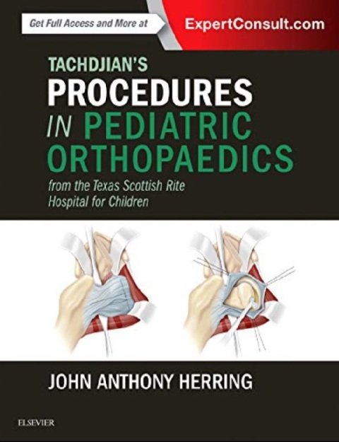 Tachdjian's Procedures in Pediatric Orthopaedics From the Texas Scottish Rite Hospital for Children 1st Edition.