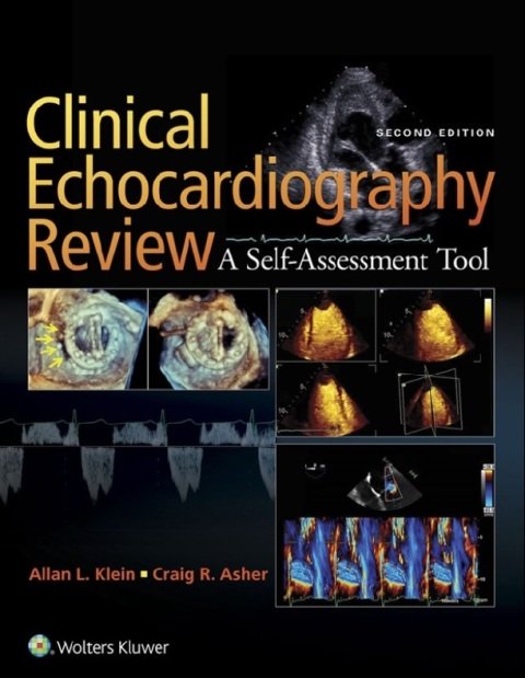 Clinical Echocardiography Review 2nd Edition.