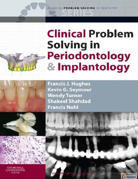 Clinical Problem Solving in Periodontology and Implantology