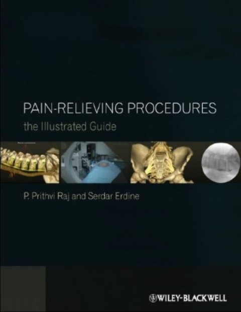 Pain-Relieving Procedures The Illustrated Guide 1st Edition.