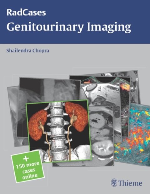 Radcases Genitourinary Imaging (Radcases Plus Q&A).