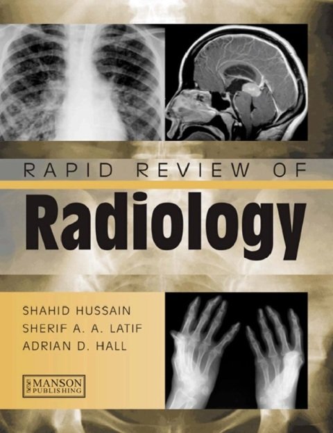 Rapid Review of Radiology (Medical Rapid Review Series) 1st Edition.