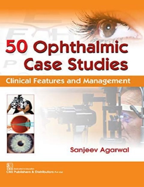 50 Ophthalmic Case Studies Clinical Features and Management