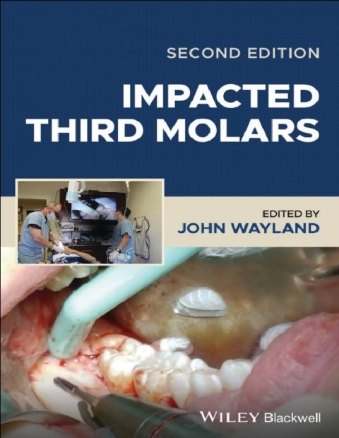 Impacted Third Molars 2nd Edition.