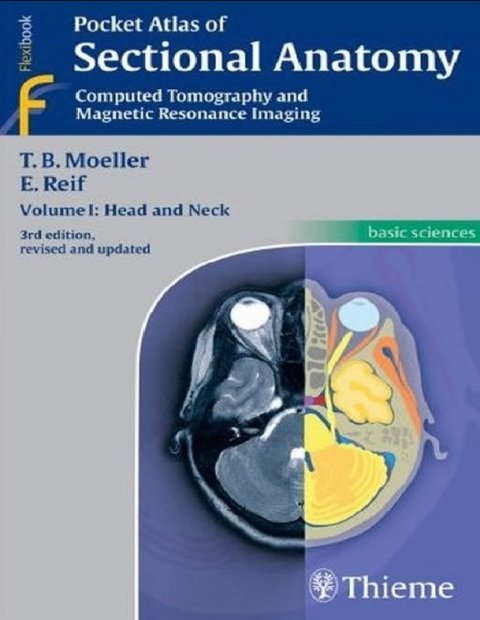 Pocket Atlas of Sectional Anatomy Computed Tomography and Magnetic Resonance Imaging Volume 1 Head and Neck.