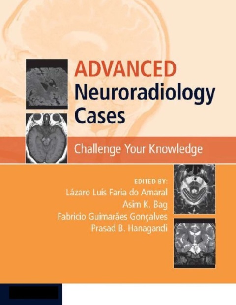Advanced Neuroradiology Cases Challenge Your Knowledge 1st Edition.
