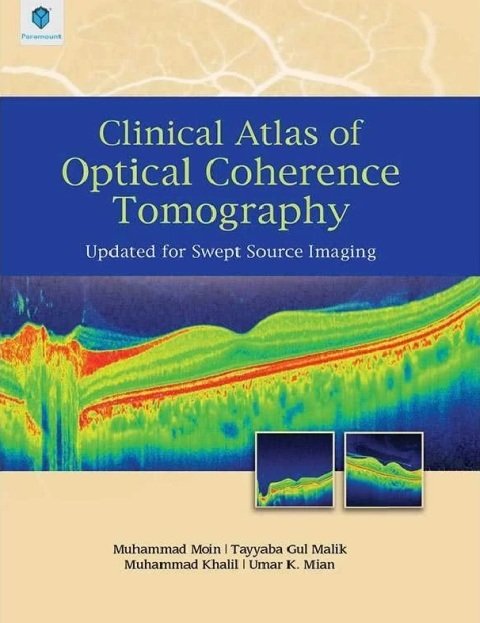CLINICAL ATLAS OF OPTICAL COHERENCE TOMOGRAPHY.