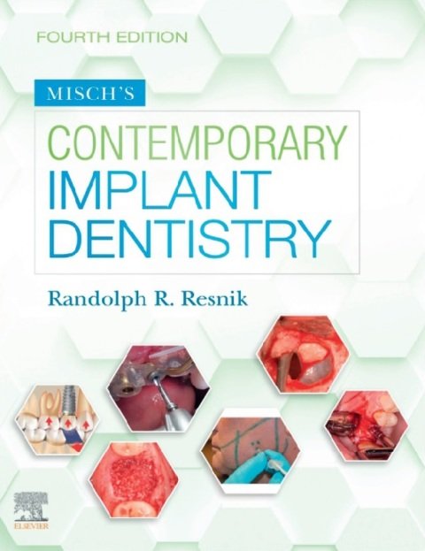 Misch's Contemporary Implant Dentistry 4th Edition.