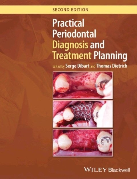 Practical Periodontal Diagnosis and Treatment Planning 2nd Edition.