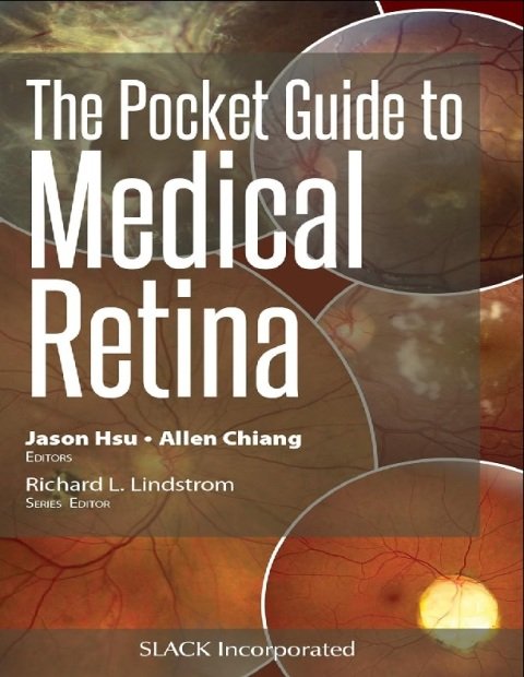 The Pocket Guide to Medical Retina (Pocket Guides) 1st Edition.