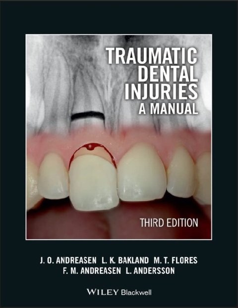 Traumatic Dental Injuries A Manual 3rd Edition.