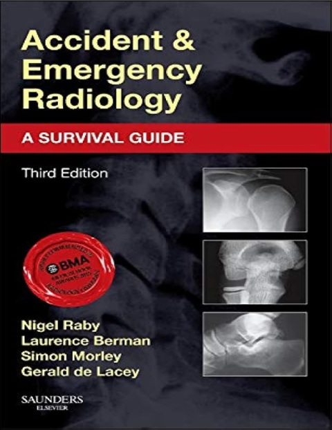 Accident and Emergency Radiology A Survival Guide.