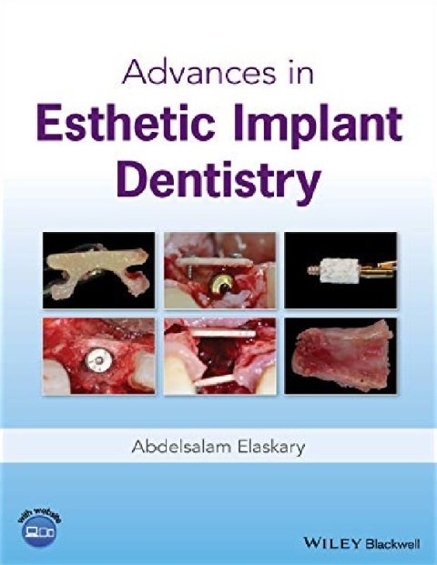 Advances in Esthetic Implant Dentistry.