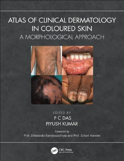 Atlas of Clinical Dermatology in Coloured Skin A Morphological Approach.