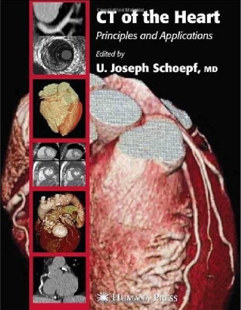 CT of the Heart Principles and Applications (Contemporary Cardiology) 1st Edition.