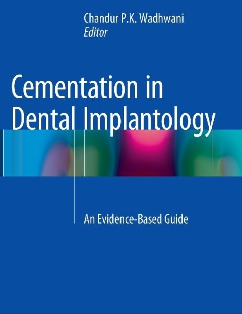 Cementation in Dental Implantology An Evidence-Based Guide.