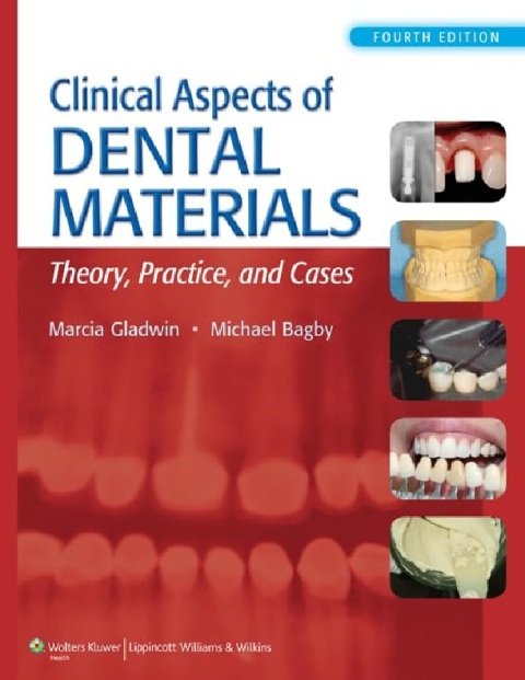 Clinical Aspects of Dental Materials Theory, Practice, and Cases.