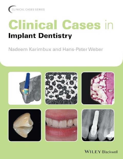 Clinical Cases in Implant Dentistry (Clinical Cases (Dentistry)).