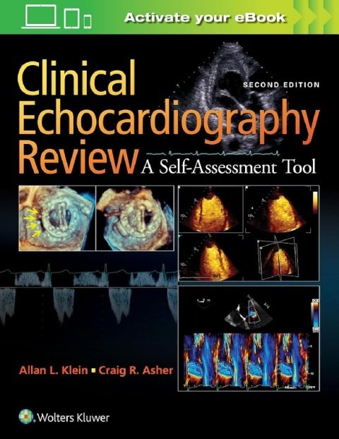 Clinical Echocardiography Review 2nd Edition.