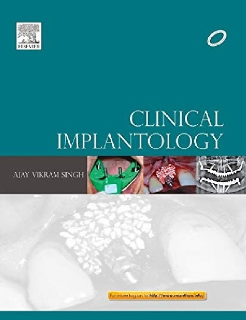 Clinical Implantology, 1e.