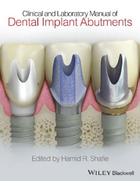Clinical and Laboratory Manual of Dental Implant Abutments.