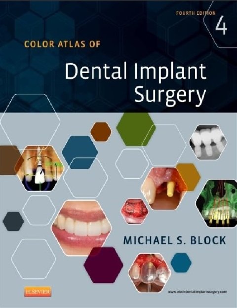 Color Atlas of Dental Implant Surgery.