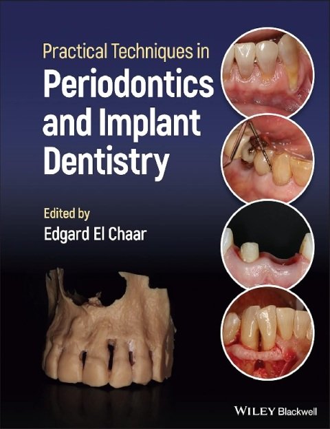 Practical Techniques in Periodontics and Implant Dentistry 1st Edition.