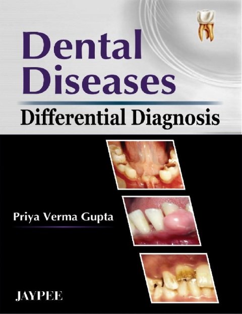 Dental Diseases (Differential Diagnosis).