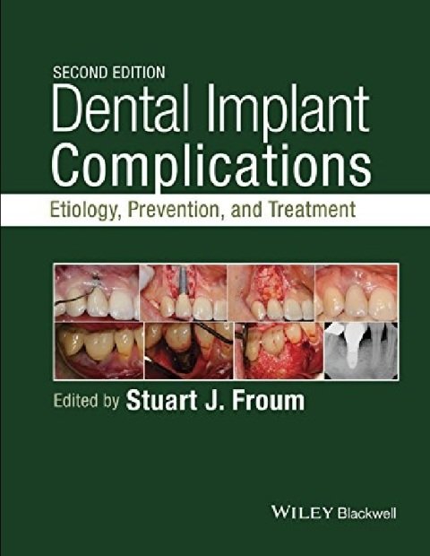 Dental Implant Complications Etiology, Prevention, and Treatment.