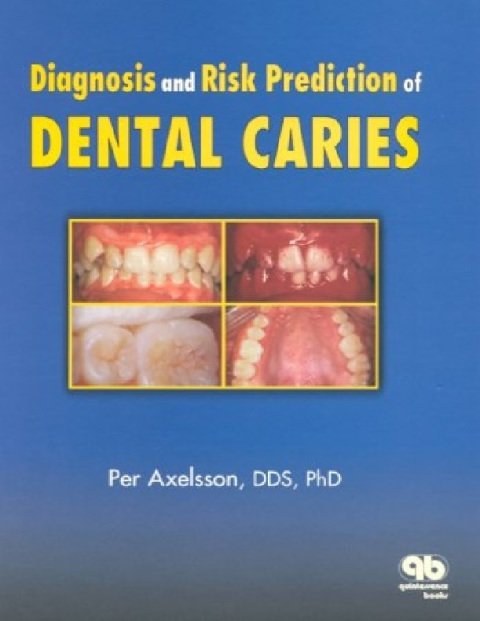 Diagnosis and Risk Prediction of Dental Caries, Volume 2.
