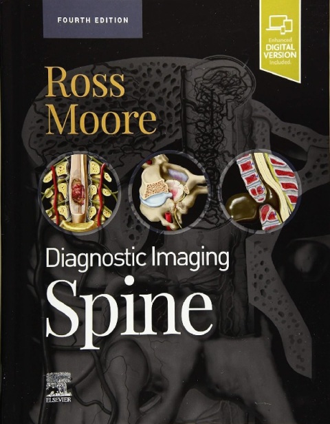 Diagnostic Imaging Spine.