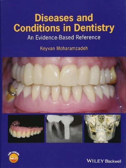Diseases and Conditions in Dentistry An Evidence-Based Reference.