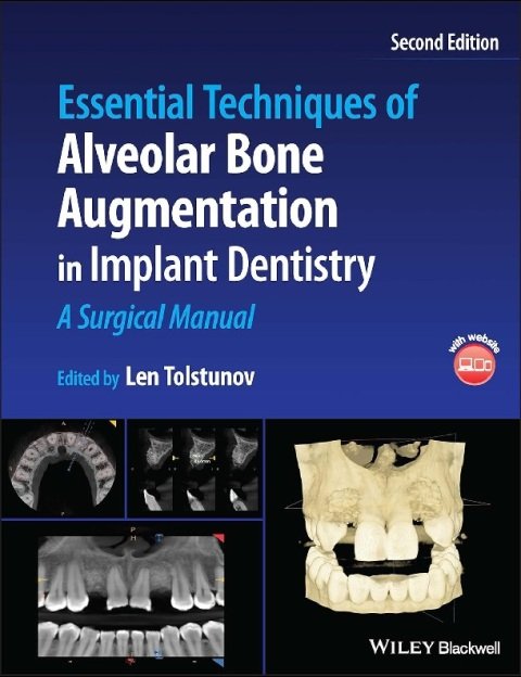 Essential Techniques of Alveolar Bone Augmentation in Implant Dentistry A Surgical Manual.