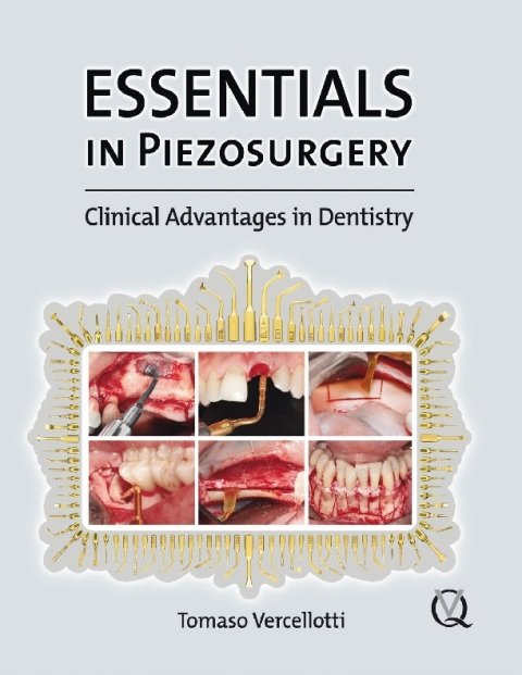 Essentials in Piezosurgery Clinical Advantages in Dentistry.