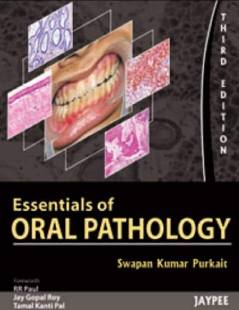 Essentials of Oral Pathology.
