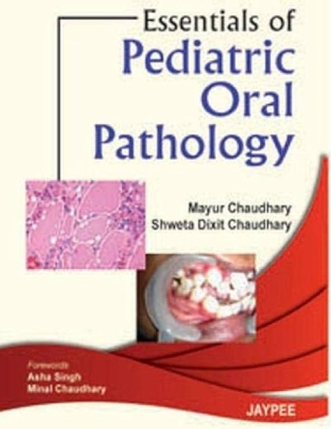 Essentials of Pediatric Oral Pathology.